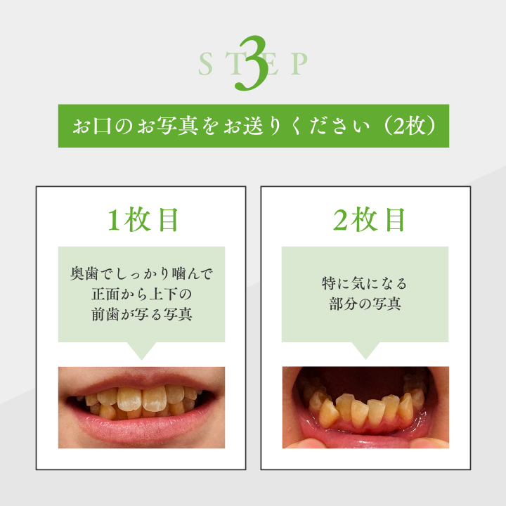 LINEで無料歯並び相談を始める手順3